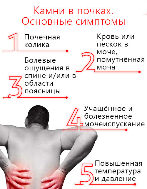 Почки где болят у женщин симптомы фото Protocol for the management of patients with renal colic in nephrolithiasis - Es