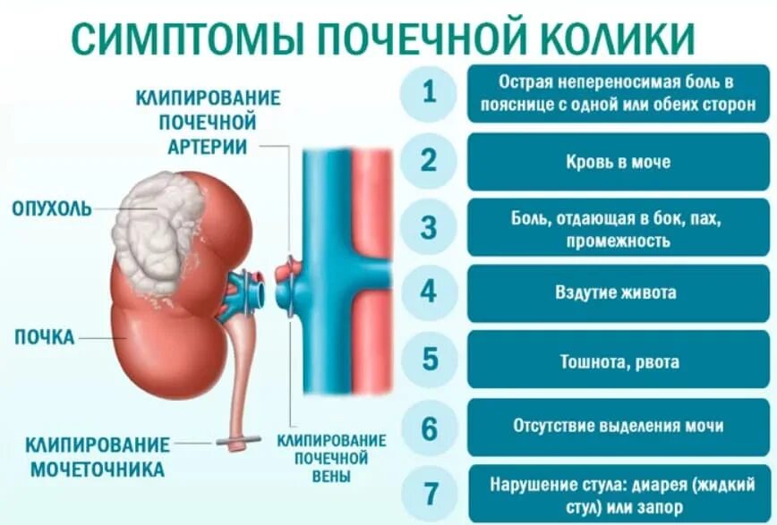 Почки где болят у женщин симптомы фото Как проявляется болезнь почек симптомы: найдено 73 изображений