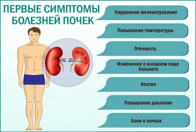 Почки где болят у женщин симптомы фото Нефрологический центр с отделение гемодиализа - Медикал Групп - Новости