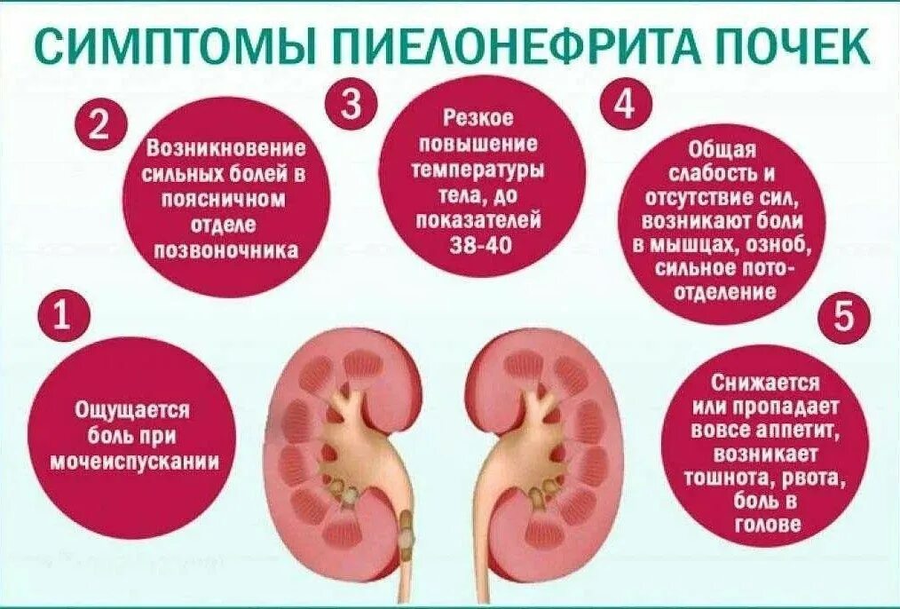 Почки где болят у женщин симптомы фото Нефрологический центр с отделение гемодиализа - Медикал Групп - Новости