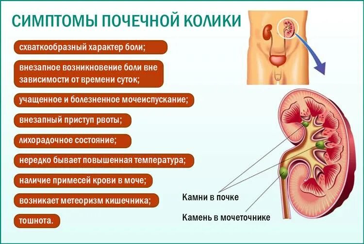 Почки где болят у женщин симптомы фото Больные почки симптомы и признаки