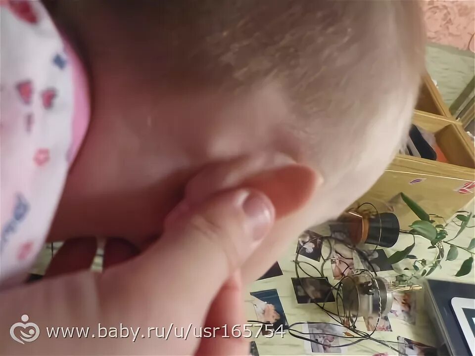 Под ухом шишка что это фото Почему за ушами у грудничков появляются твердые, мягкие шишечки: что это такое