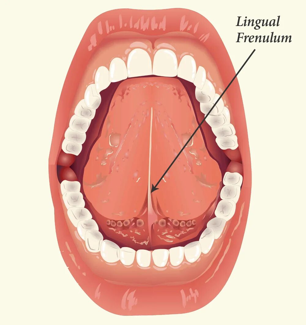 Под языком синие вены фото Tongue Tie - CV ENT Surgical Group