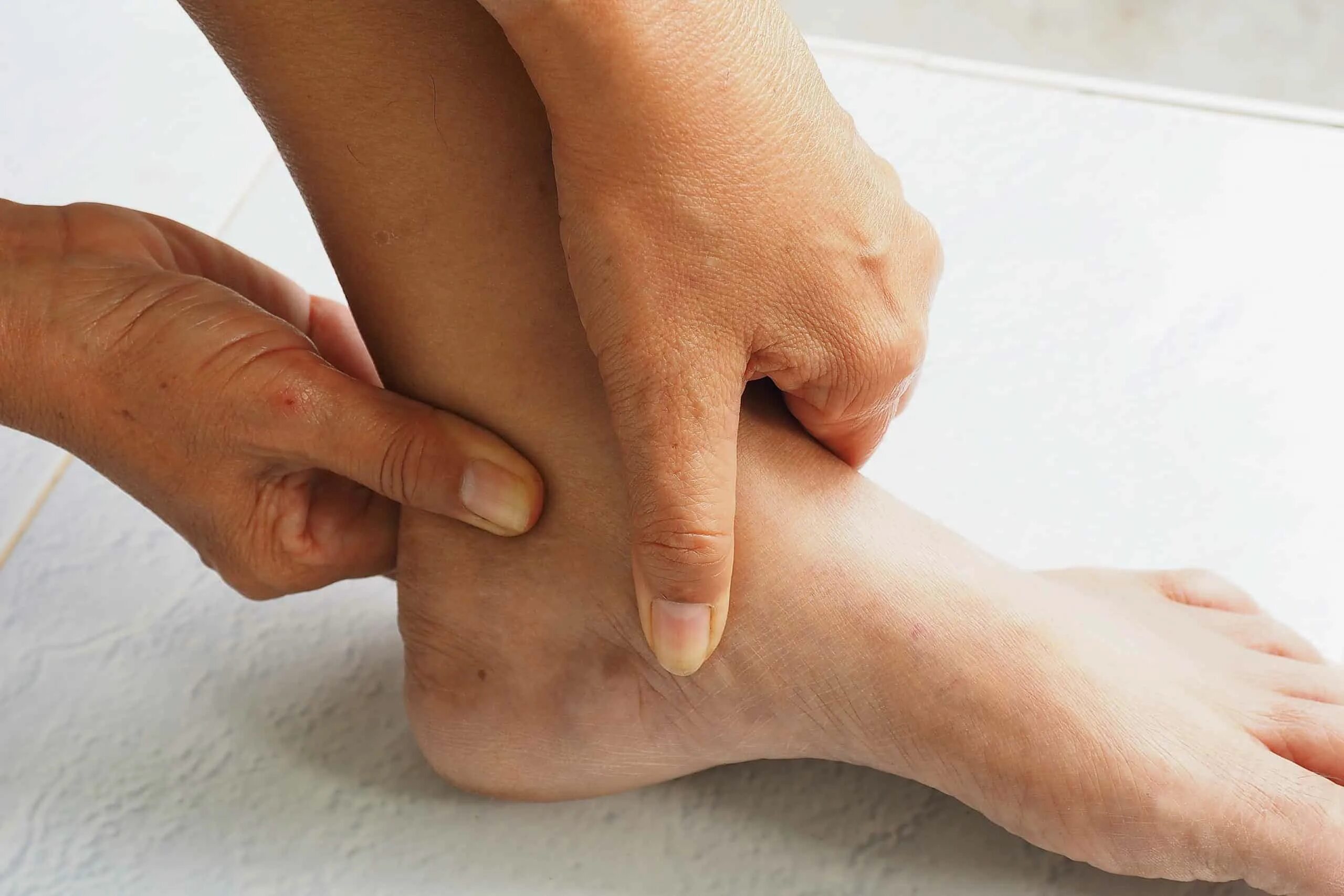 Подагра голеностопного сустава симптомы и лечение фото Partial Tendon Tear Doctor in San Diego Patient Success with Dr. Ambach