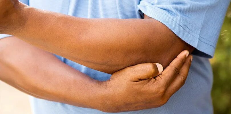 Подагра локтевого сустава симптомы и лечение фото Pin on Health Tips