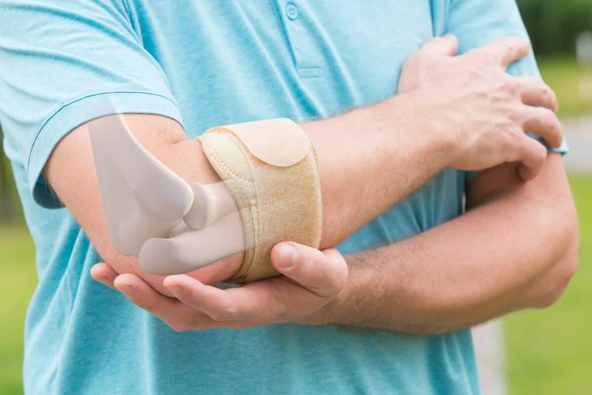 Подагра локтевого сустава симптомы и лечение фото Tennis elbow Special Orthopaedic Hospital Dr. Nemec