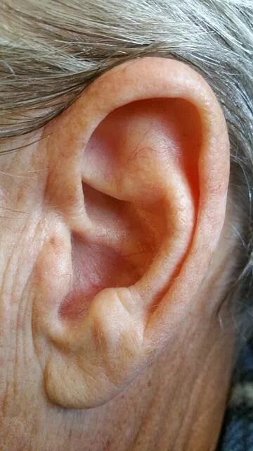 Подагра на ушах фото Oreille Corps Humain - Photo gratuite sur Pixabay Dessin oreille, Oreille, Photo