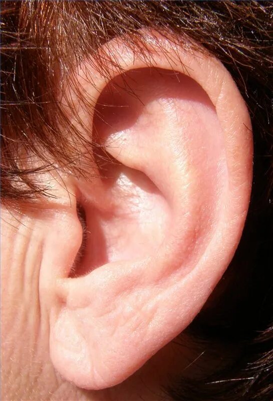 Подагра на ушах фото Adult ear