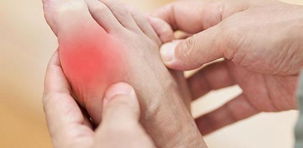 Подагра симптомы фото inflammation University of Cambridge