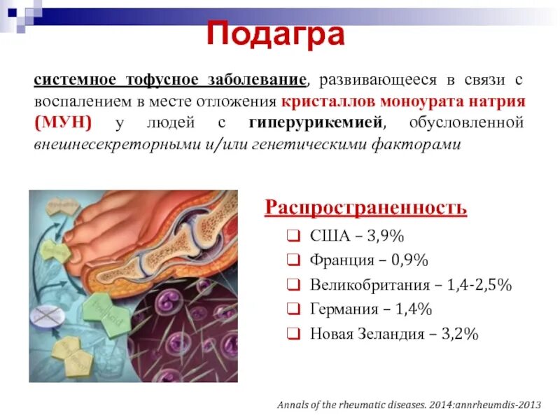 Подагра симптомы фото ПОДАГРА презентация, доклад