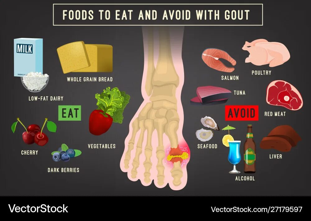 Подагра симптомы лечение фото Avoid Eating Vector Images (over 630)