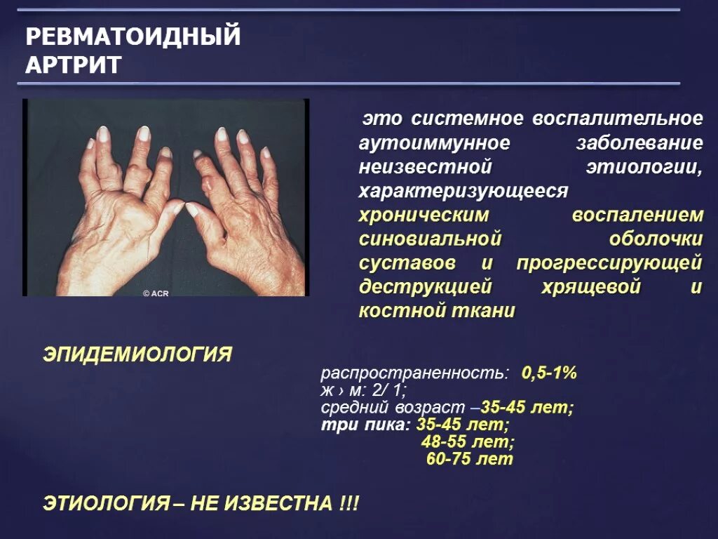 Подагра симптомы у женщин на руках фото Ревматоидный фактор повышен лечение