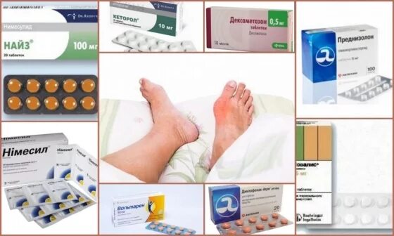 Подагра таблетки фото Painkillers for gout: tablets, ointments, injections