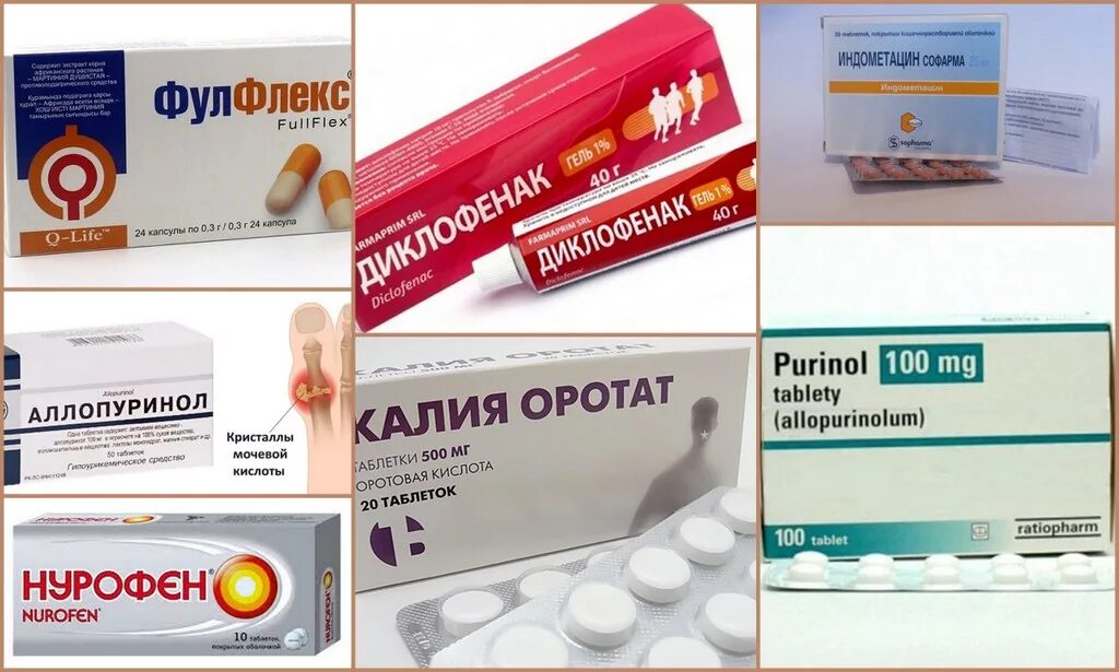 Подагра таблетки фото Таблетки от подагры: обзор эффективных препаратов