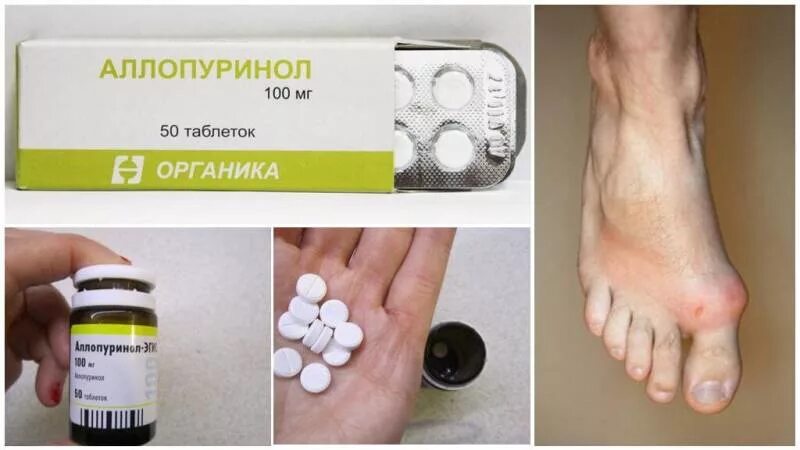 Подагра таблетки фото Лекарства при подагре Азбука здоровья