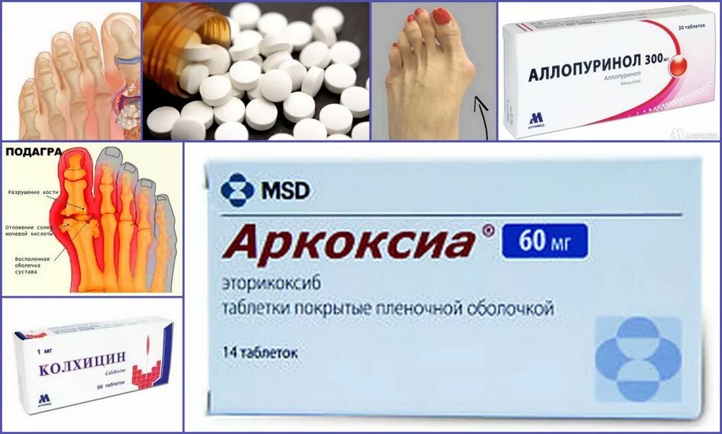 Подагра таблетки фото Аркоксиа при подагре: помогает ли лекарство, цена, отзывы