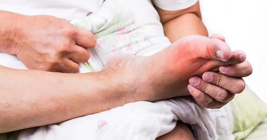Подагра у детей симптомы и лечение фото Best Shoes for Gout - Footwear for Gout Sufferers - Softstar Blog