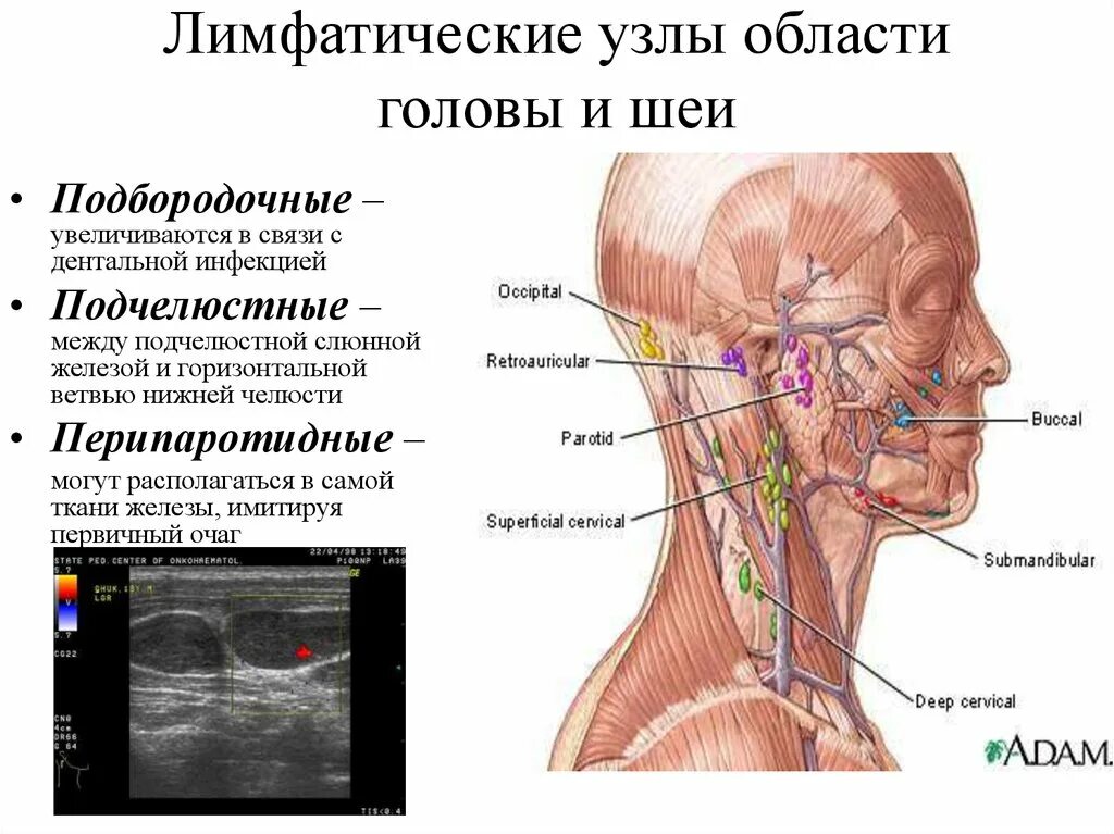 Подчелюстные лимфоузлы расположение схема Картинки УВЕЛИЧЕНИЕ РАЗМЕРОВ ЛИМФАТИЧЕСКИХ УЗЛОВ