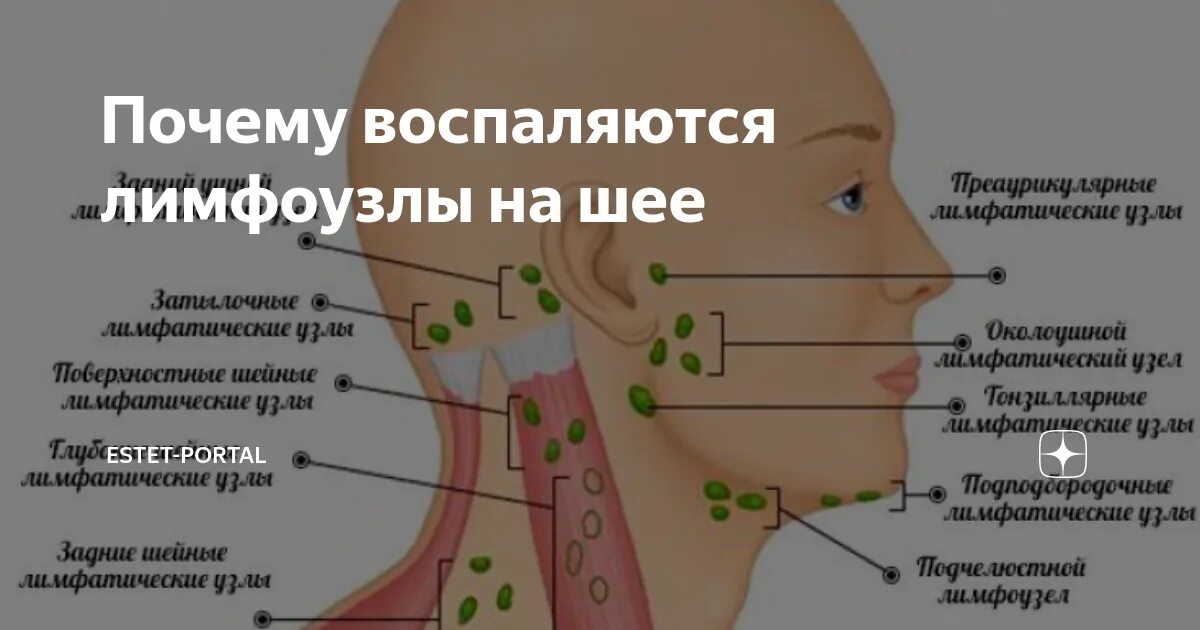 Подчелюстные лимфоузлы расположение схема Шейные лимфатические узлы у ребенка