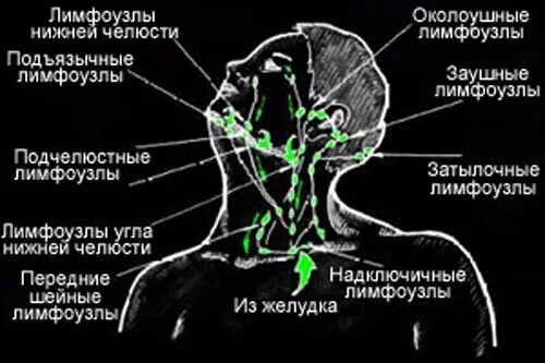 Подчелюстные лимфоузлы расположение схема Лимфоузлы шеи кт: найдено 78 картинок