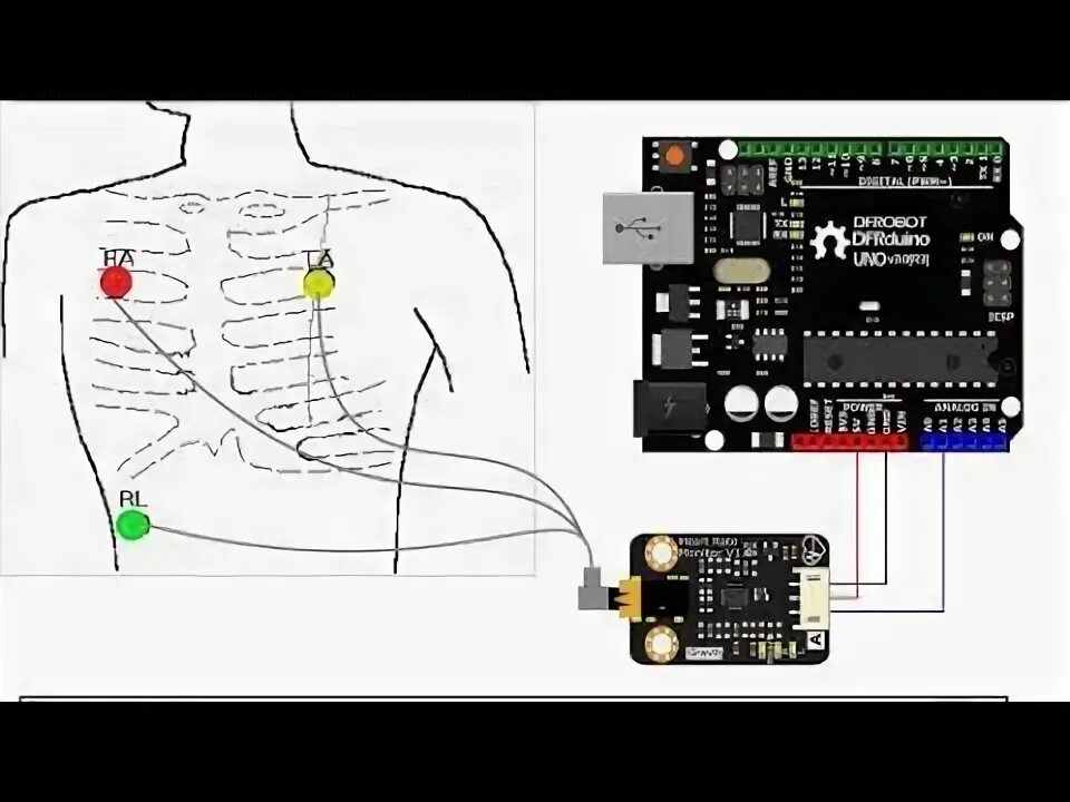 Подключение датчиков экг ECG MACHINE WITH HELP OF ARDUINO II ARDUINO PROJECTS - YouTube