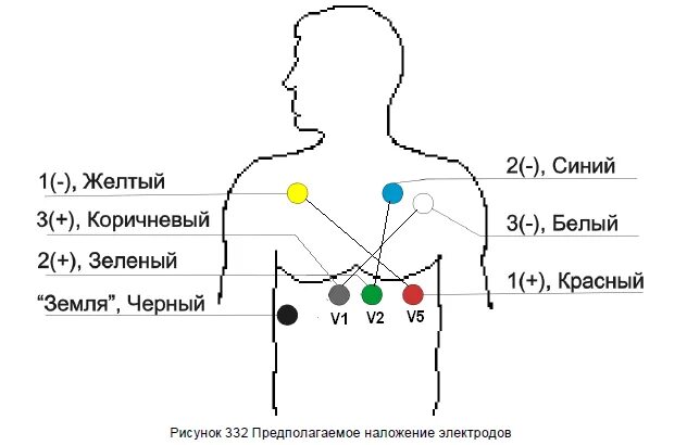 Модуль для ЭКГ на базе AD8232 - купить с доставкой по выгодным ценам в интернет-