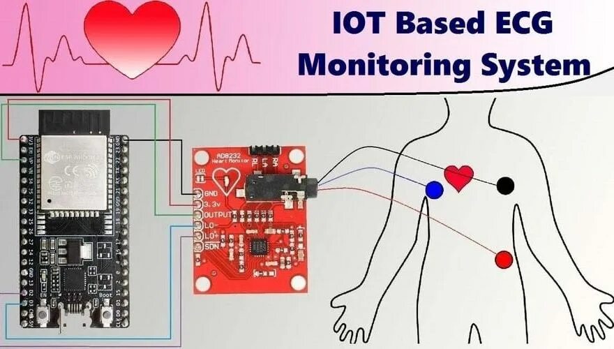 Подключение датчиков экг IoT-based Heart Monitoring with ESP32 Espressif Systems