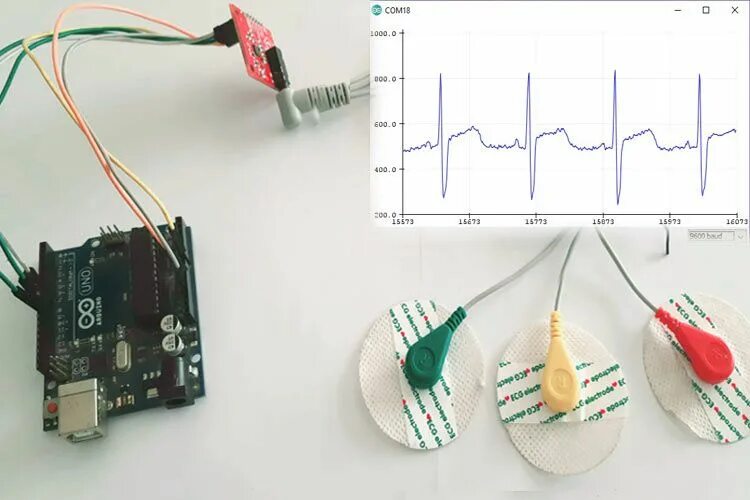 Подключение датчиков экг Understanding ECG Sensors for Medical Diagnosis