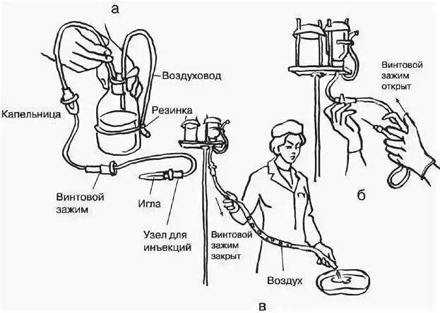 Подключение инфузионной системы Техника заполнения системы внутривенного капельного вливания - Студопедия