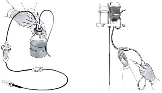 Подключение инфузионной системы Организация работы медицинской сестры манипуляционного кабинета