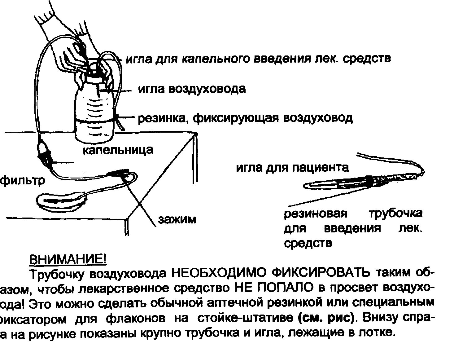 Подключение капельной системы Этапы внутривенно-капельного введения лекарственных средств.