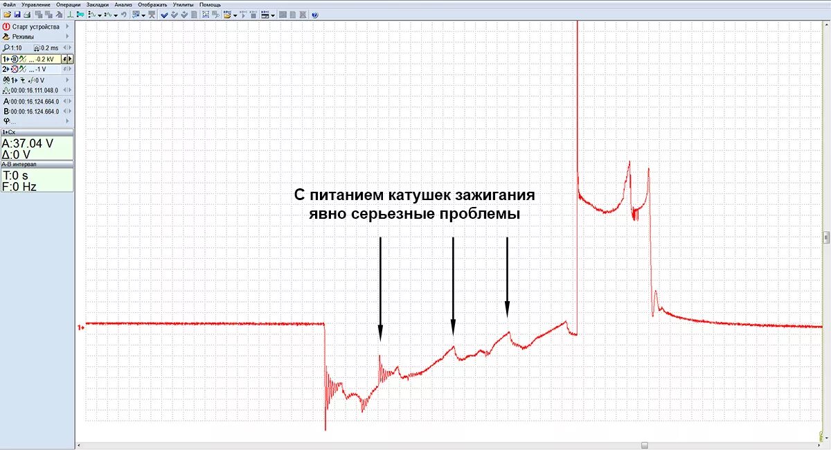 Подключение осциллографа к катушке зажигания Практика реальной диагностики: как определить проблемы.