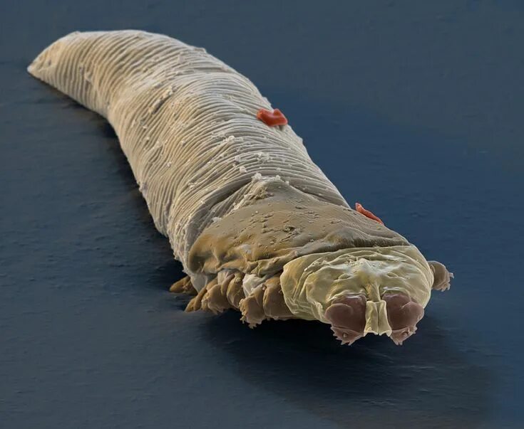 Подкожный клещ на ресницах фото 404 Not Found Demodex mites, Demodex, Eye mites