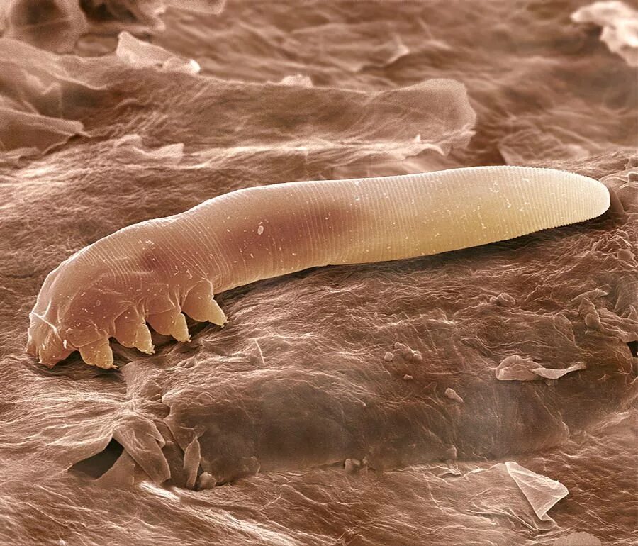 Подкожный клещ у человека на теле фото Eyelash Mite, Sem by Power And Syred in 2022 Things under a microscope, Microsco