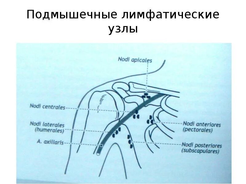 Подмышечные лимфоузлы расположение у женщин схема Лимфатическая система