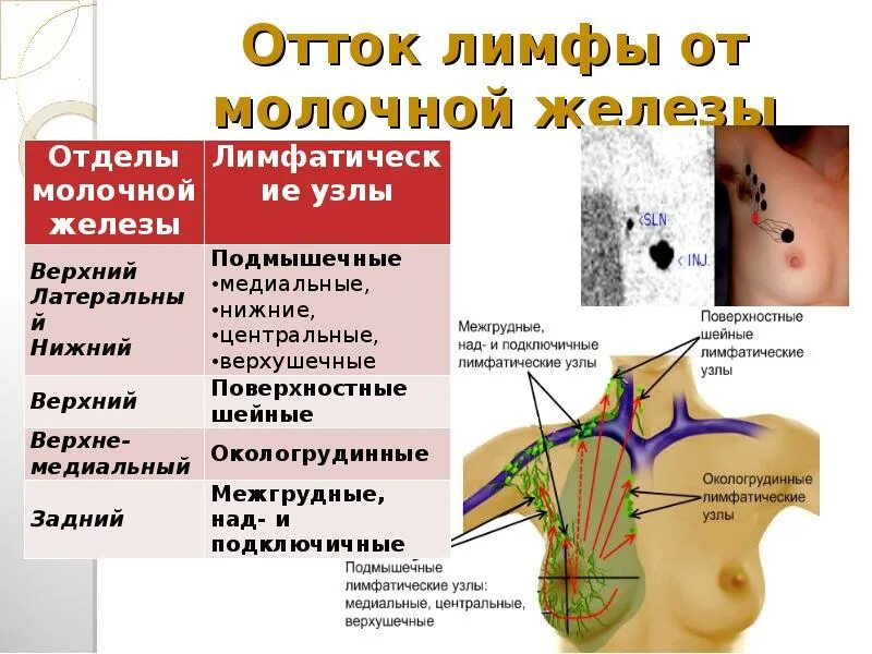 Подмышечные лимфоузлы расположение у женщин схема Подмышечные лимфатические узлы