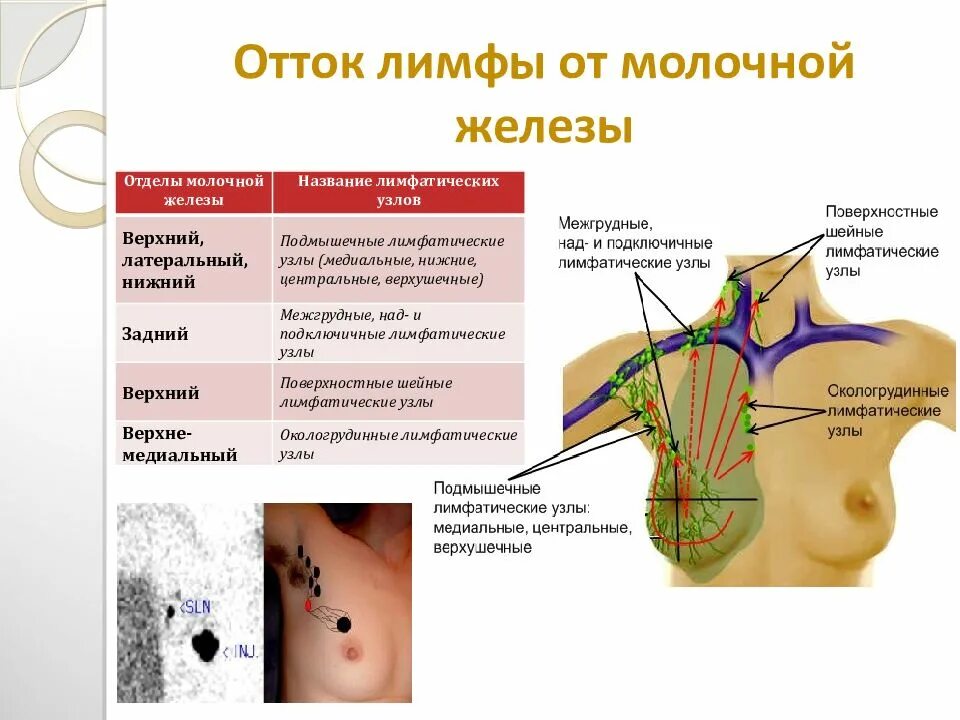 Подмышечные лимфоузлы расположение у женщин схема Где подмышечные лимфоузлы