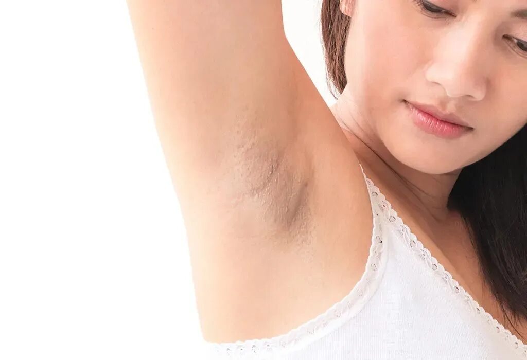 Подмышки какой лишай бывает фото Dark Underarm Hair Removal Top Sellers poligraf-ti.kz