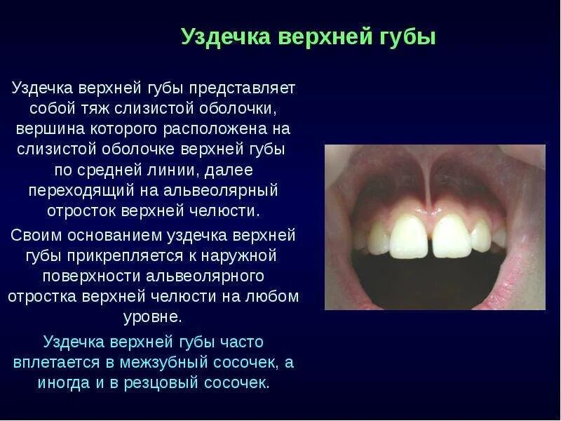 Подрезать уздечку верхней губы взрослому фото Патология слизистой оболочки полости рта 2015 - презентация, доклад, проект скач