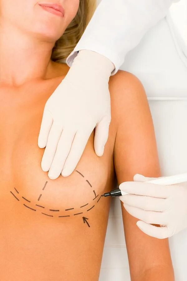 Подтяжка груди чебоксары цена фото Breast Enlargement Plastic And Reconstructive Store podlokot.ru