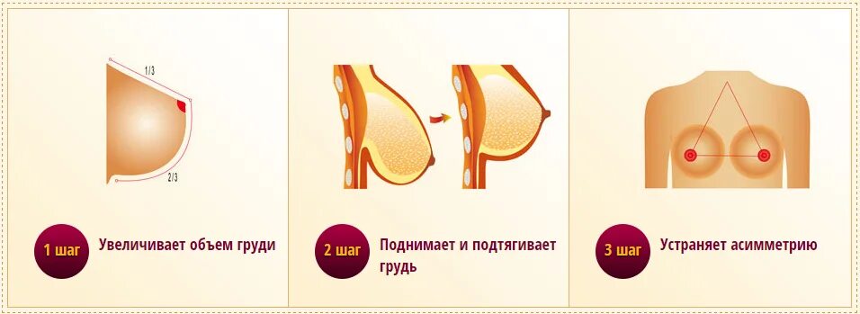 Подтяжка груди волгоград цена и отзывы фото пуэрария мирифика - SiamGarden