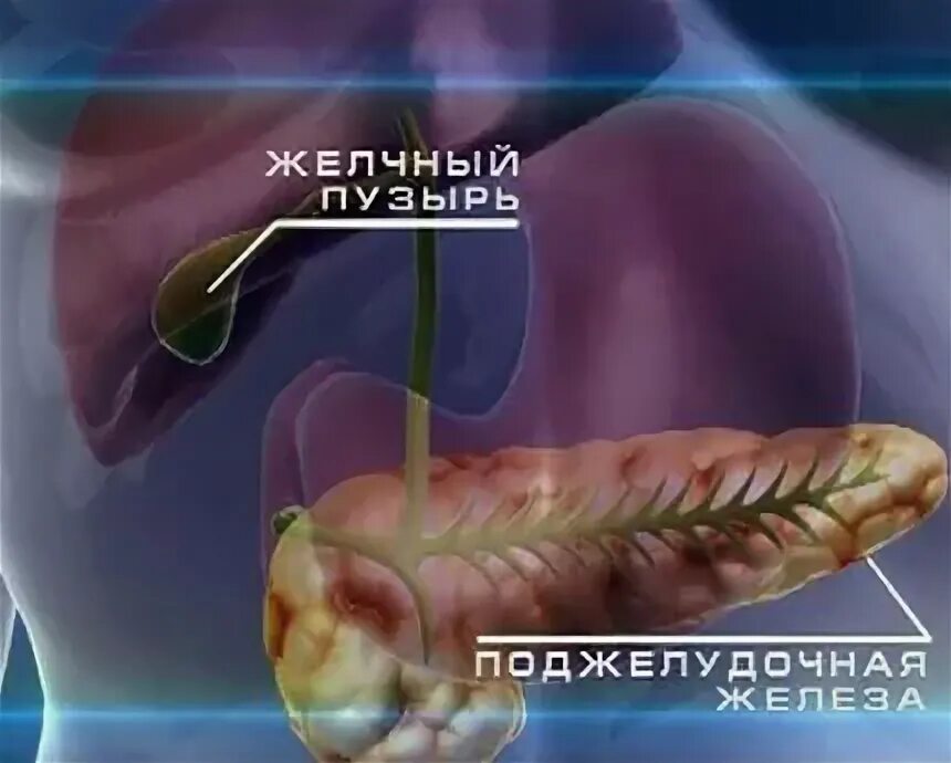 Поджелудочный камень фото Синдром желчного пузыря: найдено 86 изображений