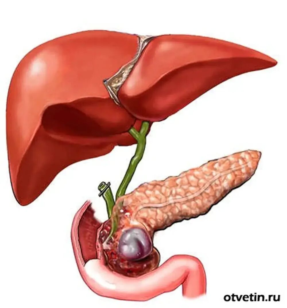 Поджелудочный камень фото Картинки ЧТО ДЕЛАЕТ ПОДЖЕЛУДОЧНАЯ ПЕЧЕНЬ