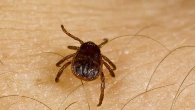 Похожие на клещей фото Murdoch University researchers found new bacteria in Australian ticks removed fr