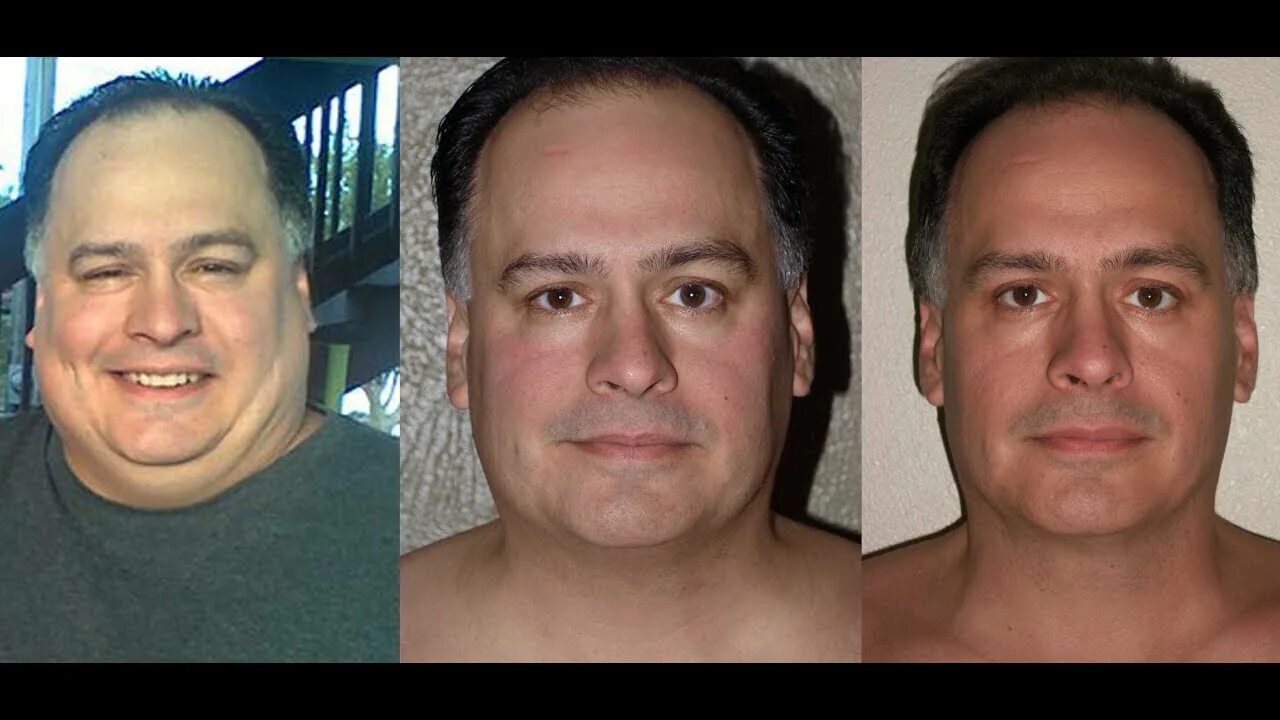 Похудение лица до и после фото мужчины FACE SHOTS! BEFORE AND AFTER WEIGHT LOSS RESULTS OF JUICE FASTING AND RAW FOODS 