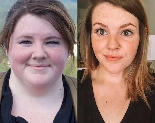 Похудение лица фото The face changes dramatically after losing weight. 2022 ★ ГТО ★ ГОТОВ К ТРУДУ И 