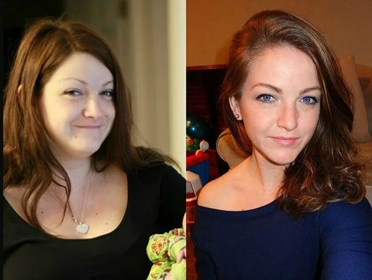 Похудение лица фото Looks truly gorgeous! 16 Amazing Weight Loss Before and After Transformations!