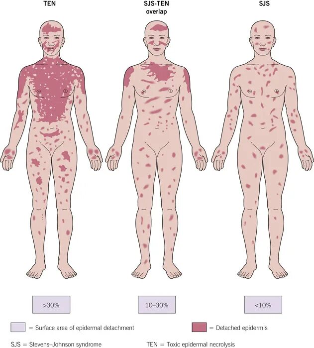 Поиск сыпи по фото Epidermal Injury/Necrosis Plastic Surgery Key