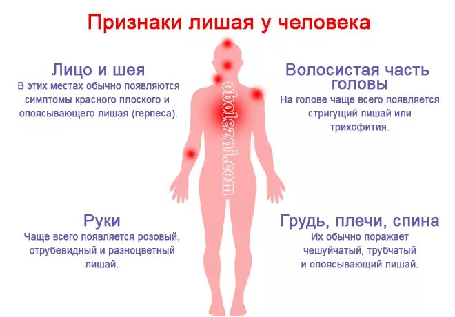 Показать как выглядит лишай Герпес на теле у ребенка: рекомендации педиатра и 6 этапов развития болезни