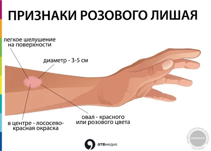 Показать как выглядит лишай DERMAQUEST " Розовый лишай Статьи Отзывы Купить